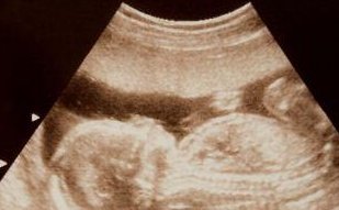 泰国三代试管婴儿费用分配解析